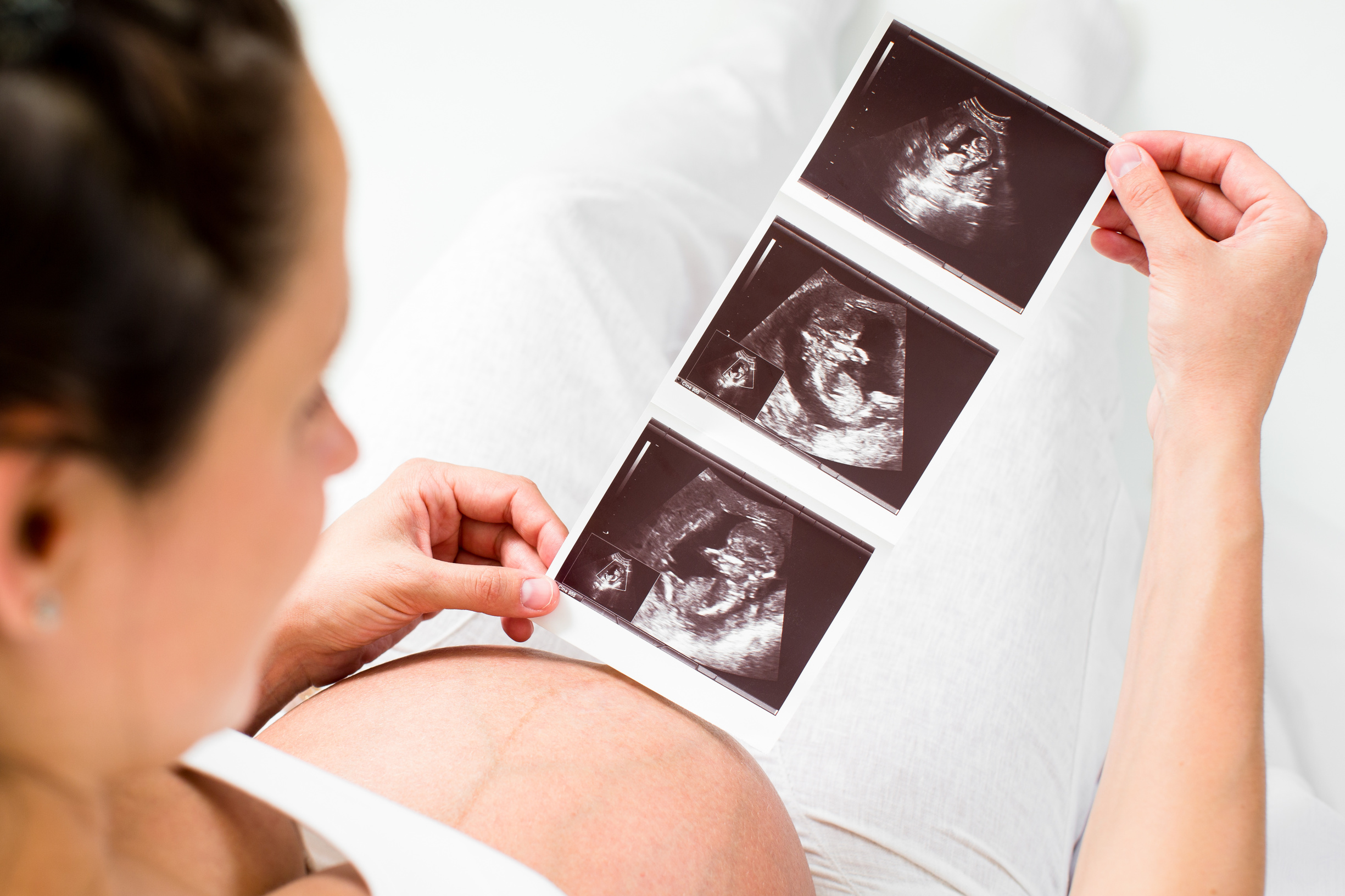 2d ultrasound pictures
